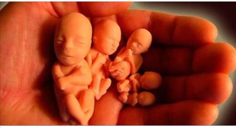 Cảnh tượng bi thương nhìn thấy tại không gian khác sau khi phá thai