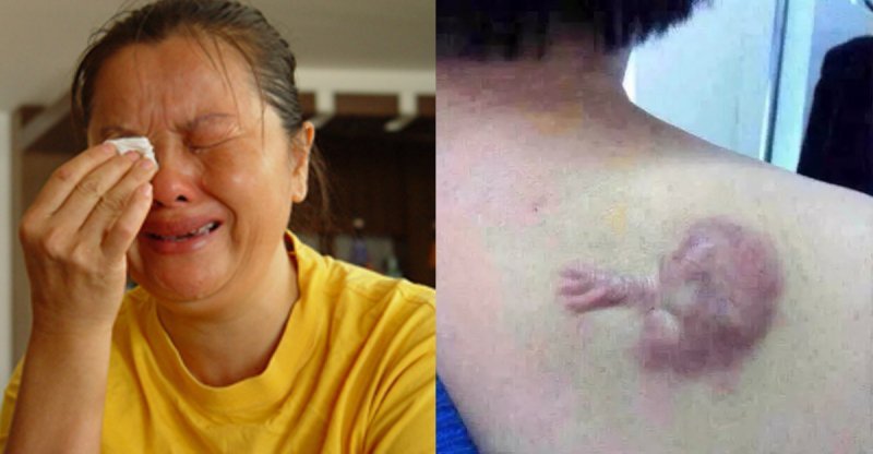 Nữ bác sĩ phá thai tạo ác nghiệp, hình thù kỳ dị xuất hiện trên thân