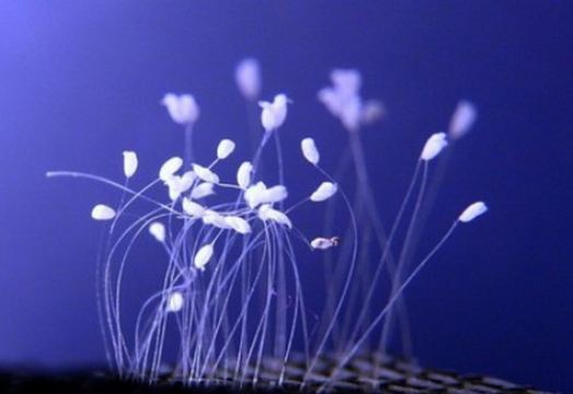 Ca khúc: Hoa Ưu Đàm